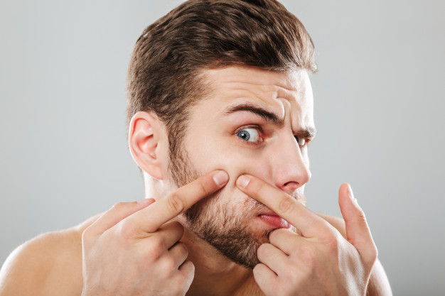 Proven Ways to Treat Acne for Men