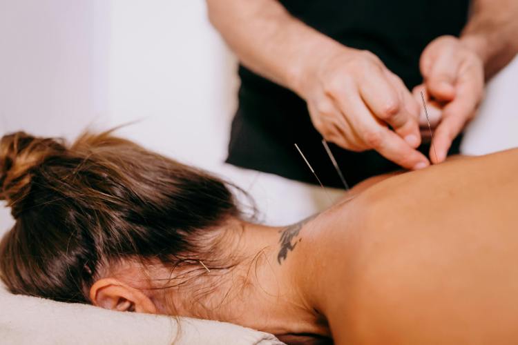 Ancient Wisdom Meets Modern Health: Real Acupuncture Benefits Explained